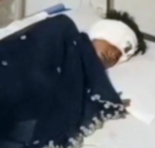 अज्ञात जंगली जानवर ने किशोरी काे किया जख्मी