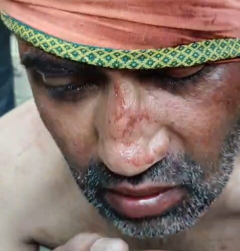 चंदौली: अस्पताल में भर्ती महिला मरीज की गोली मार कर हत्या,आरोपित को क्षेत्रीय लोगों ने पकड़ा
