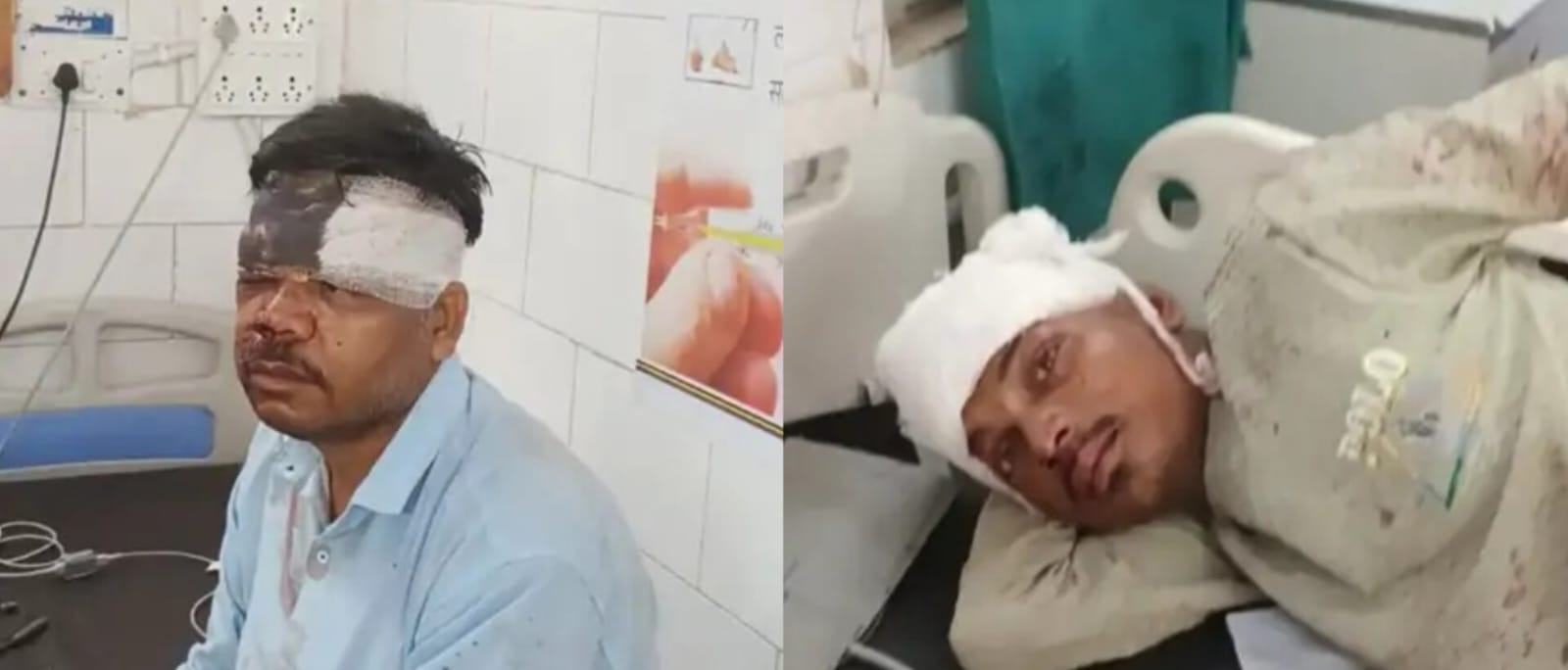 head-on-collision-between-auto