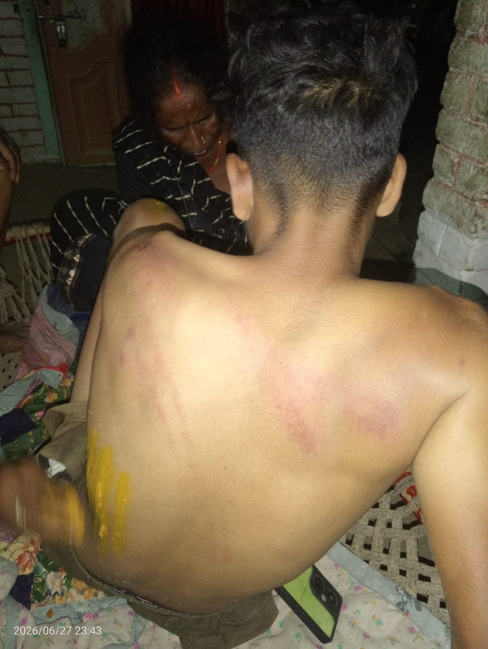 two-brothers-attacked-while-de